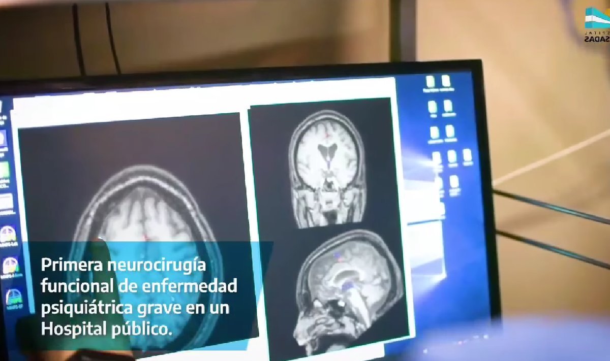 Cirug&iacute;a hist&oacute;rica en el Hospital Posadas.