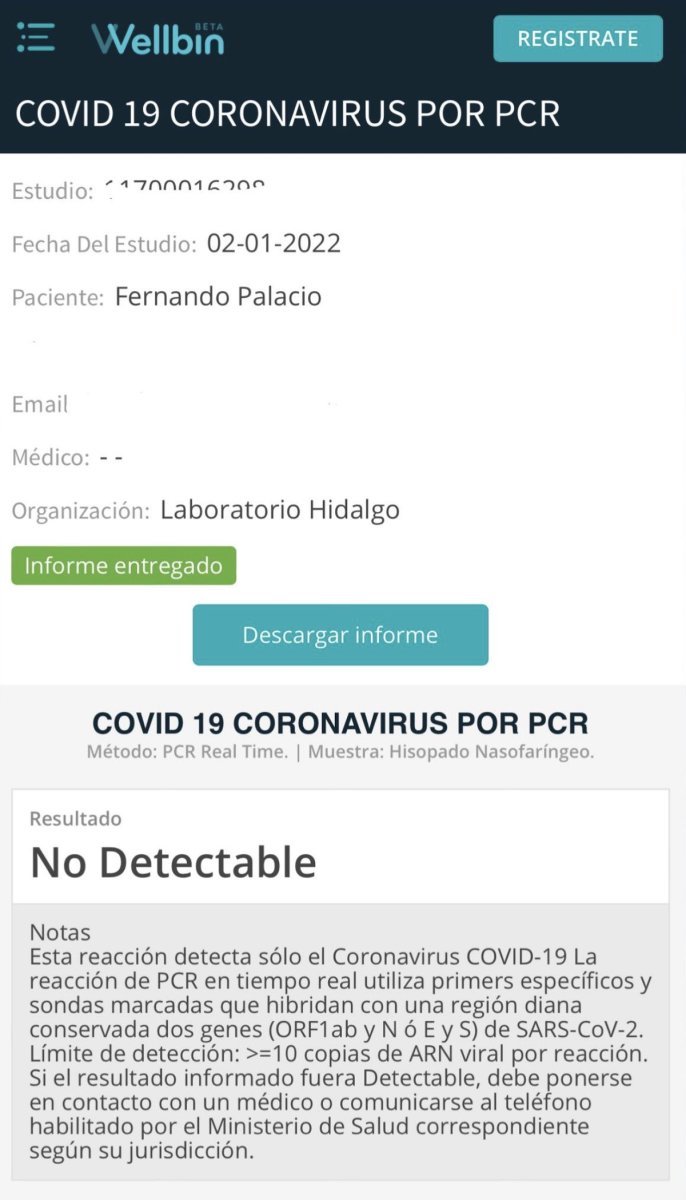 El PCR que se realiz&oacute; el artista de Gonz&aacute;lez Cat&aacute;n para poder viajar a Uruguay