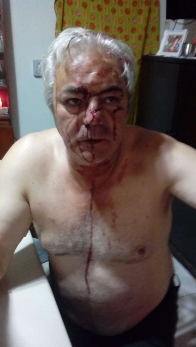 La v&iacute;ctima fue salvajemente golpeada en Castelar.