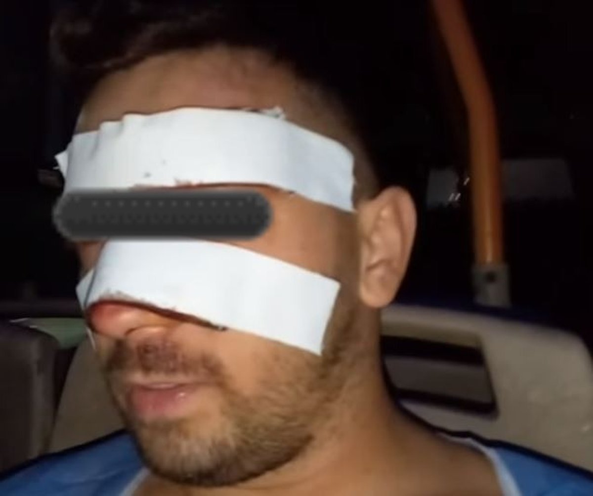 El colectivero agredido en Pontevedra.