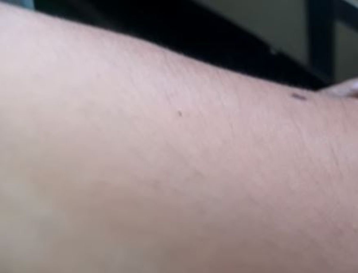 Pulgas y piojos de paloma en el Tren San Mart&iacute;n y el Urquiza.