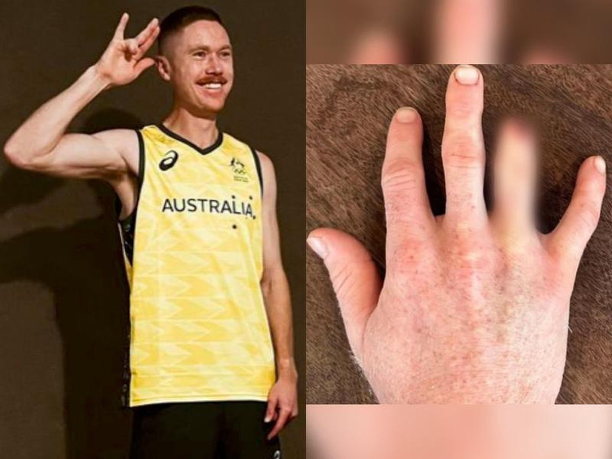 Jugador de Australia se amput&oacute; un dedo para estar en los Juegos Ol&iacute;mpicos. Foto: Exc&eacute;lsior.