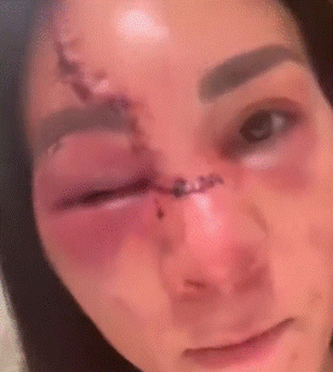 El corte de Irene Aldana en el evento de UFC 306. Foto: Paco Zea.