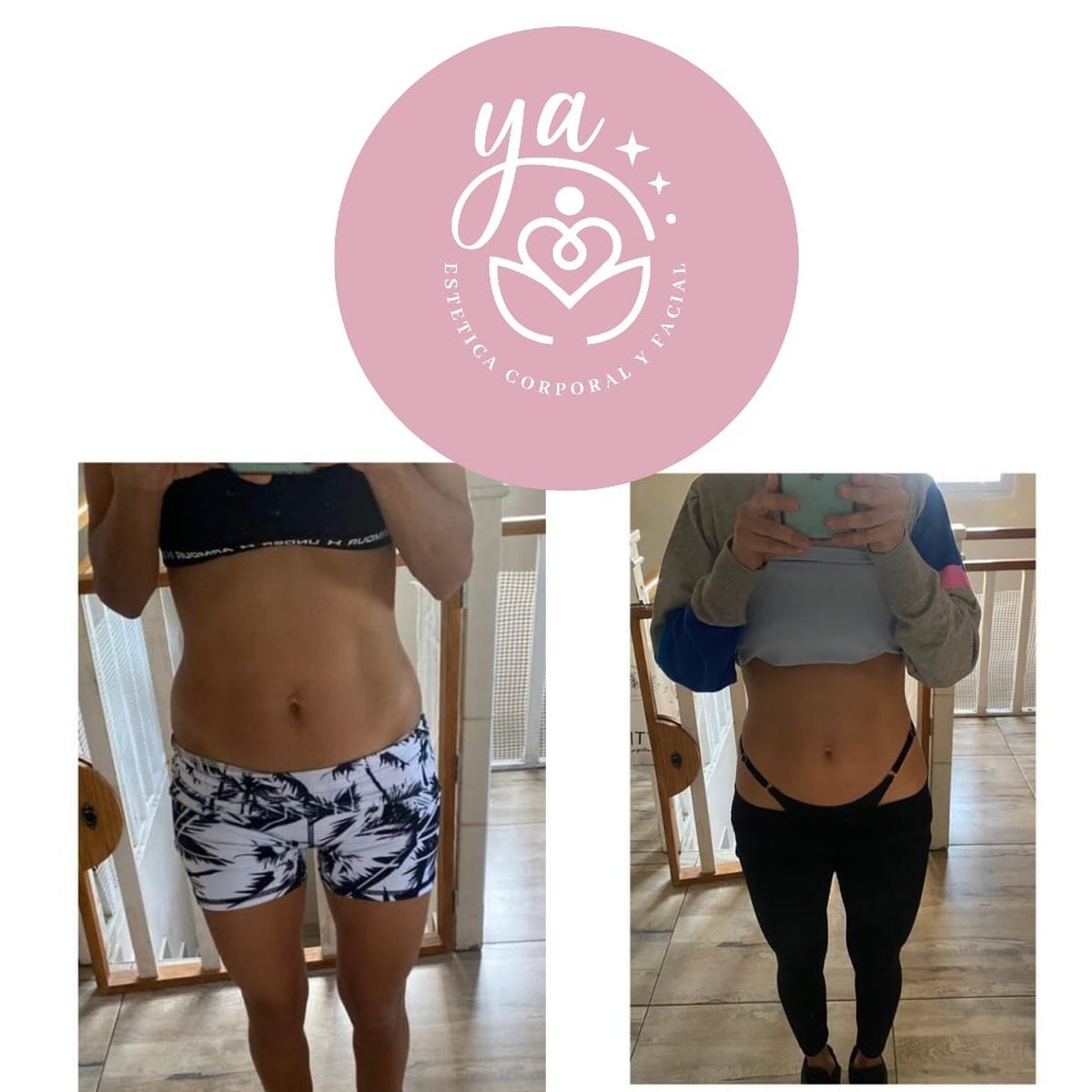 Est&eacute;tica corporal con resultados reales 