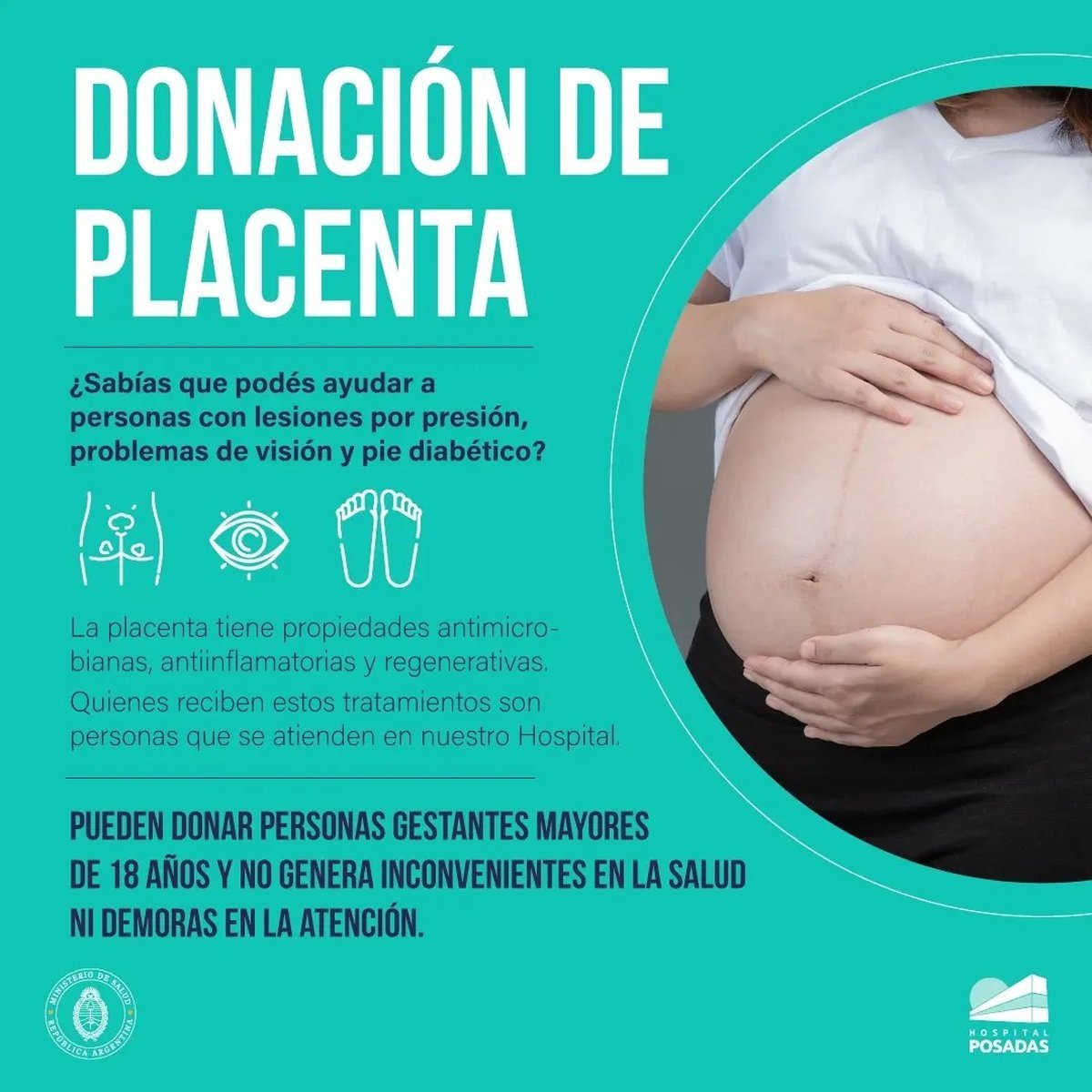 Donaci&oacute;n de placenta en el Hospital Posadas.