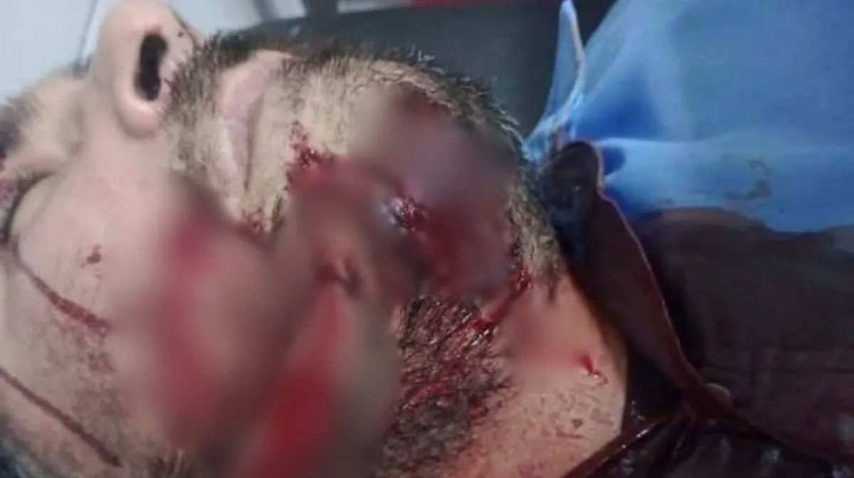 Ataque al colectivero en La Matanza.