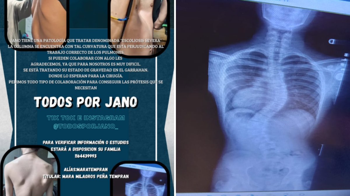 Jano, un vecino de Villa Luzuriaga que necesita una operaci&oacute;n urgente para salvar su vida.